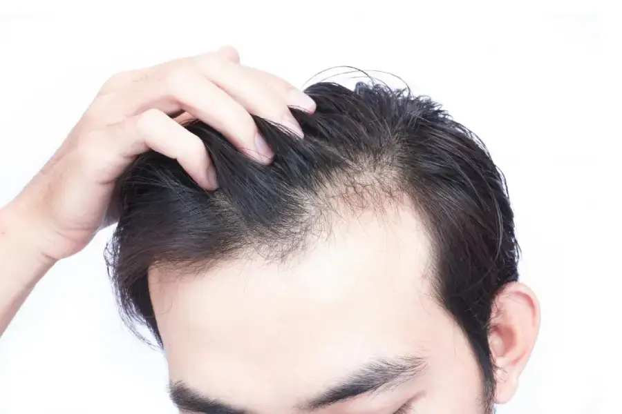 hair loss solution in Bhubaneswar