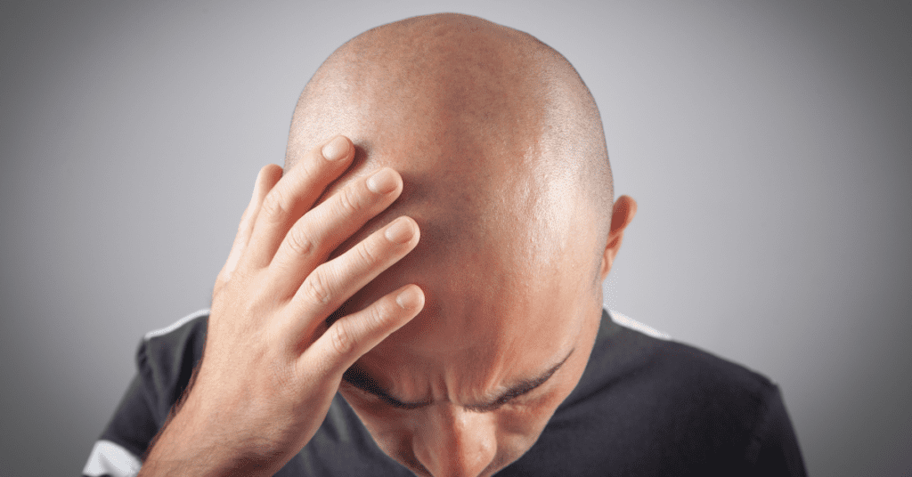 How to Know If a Hair Transplant Failed: Complete Guide