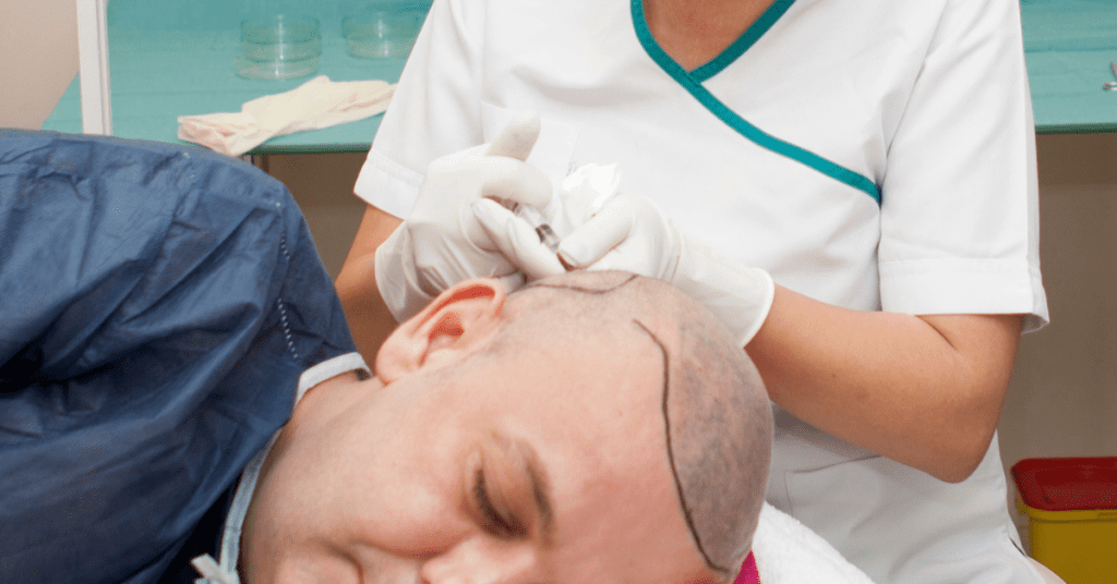 Do You Have to Take Finasteride After a Hair Transplant? - Alloroots Hair