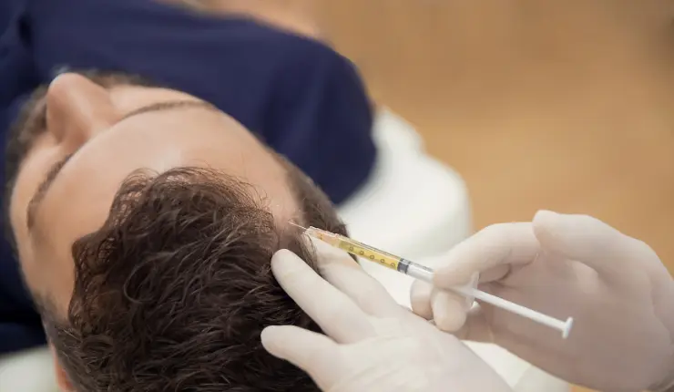 What are the before and after care for PRP treatment? 20 What are the before and after care for PRP treatment? - Alloroots Hair Transplant Clinic - India's Best Hair Transplant Services