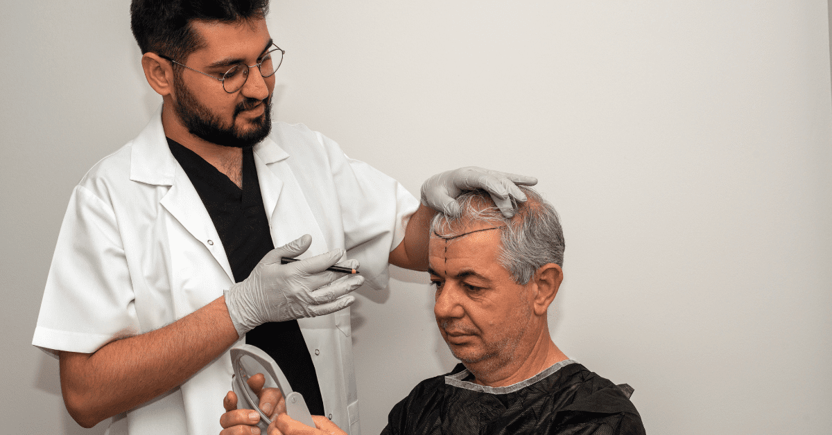 Factors Affecting the Cost of Hair Transplant in Delhi