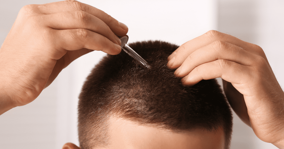 Can You Change Your Hair Texture with a Hair Transplant? - Alloroots Hair Transplant Clinic - India's Best Hair Transplant Services