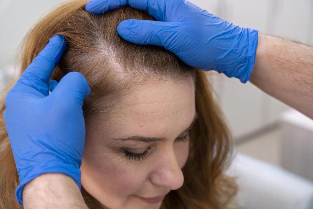 Hair line Reconstruction - Alloroots Hair Transplant Clinic - India's Best Hair Transplant Services
