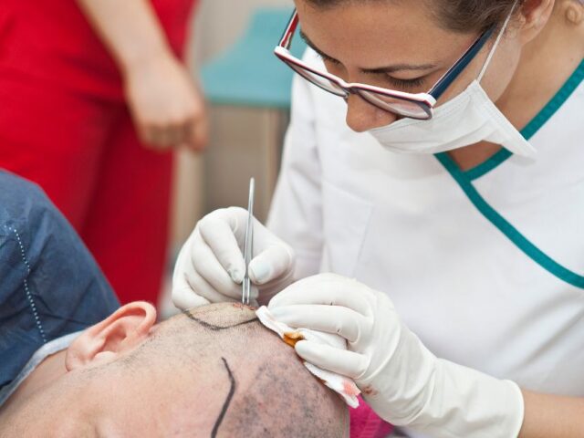 Top 10 Hair Transplant Clinics in Hyderabad: Your Complete Guide to Hair Restoration in 2025