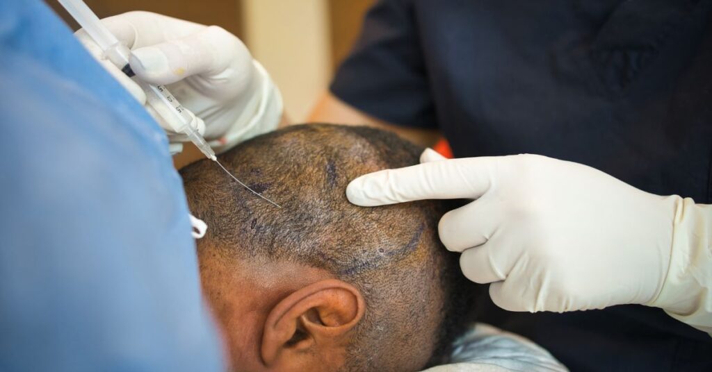 Top 10 Hair Transplant Clinics in Kochi: The Ultimate Guide (2025) 19 Hair Transplant Clinics in Kochi