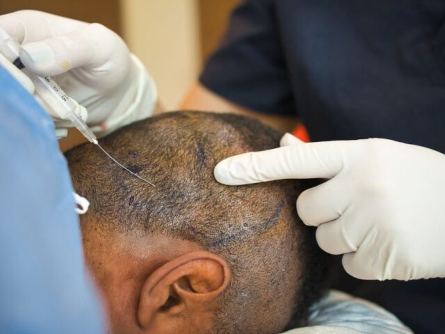 Top 10 Hair Transplant Clinics in Kochi: The Ultimate Guide (2025)
