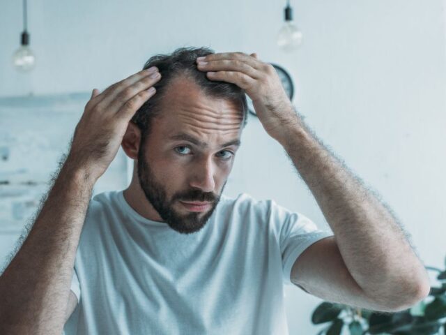 Hair Transplant Gone Wrong: Causes, Solutions, and How Alloroots Ensures Success