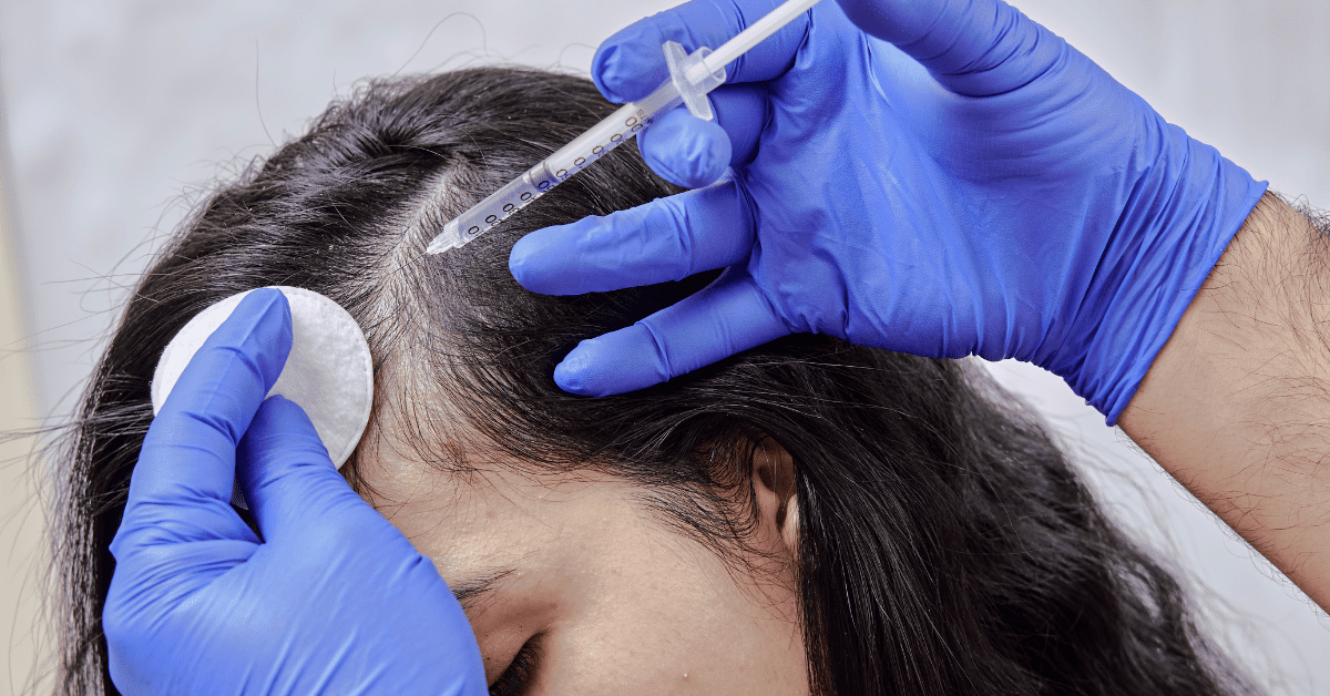 Best 15 Multivitamins for Hair Growth in 2025: Expert Picks by Alloroots - Alloroots Hair Transplant Clinic - India's Best Hair Transplant Services