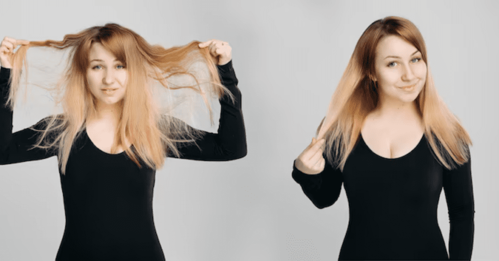 Difference Between Hair Fall and Hair Loss - Alloroots Hair Transplant Clinic - India's Best Hair Transplant Services