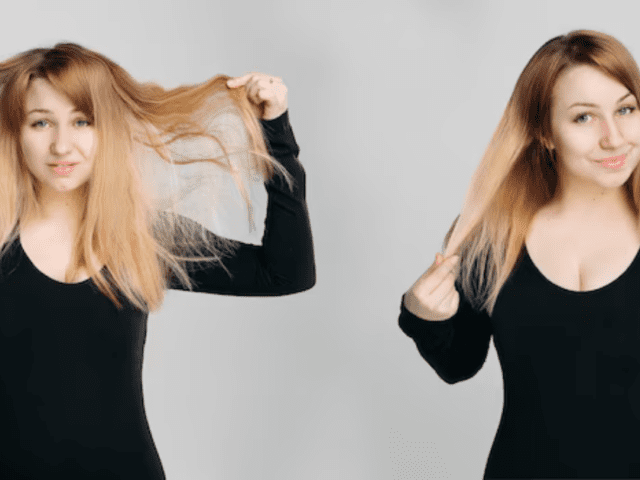 Difference Between Hair Fall and Hair Loss