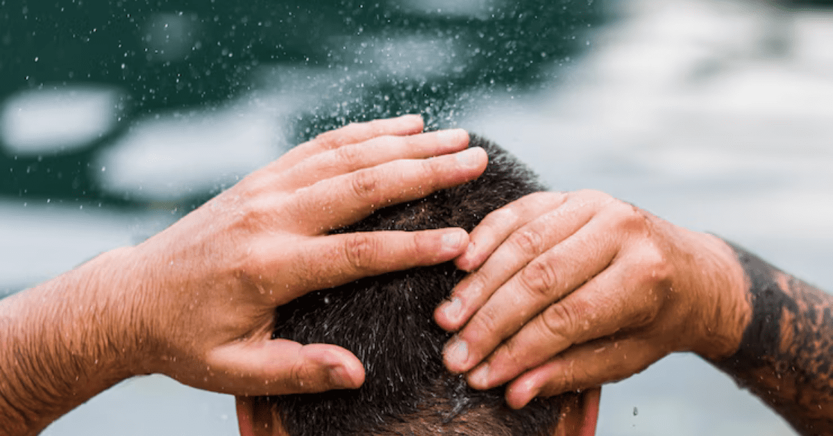 Why Hair Loss in Monsoon Season - Alloroots Hair Transplant Clinic - India's Best Hair Transplant Services