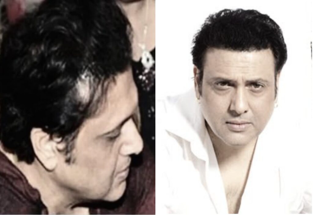 Bollywood Celebrity Hair Transplant Analysis - Alloroots Hair Transplant Clinic - India's Best Hair Transplant Services