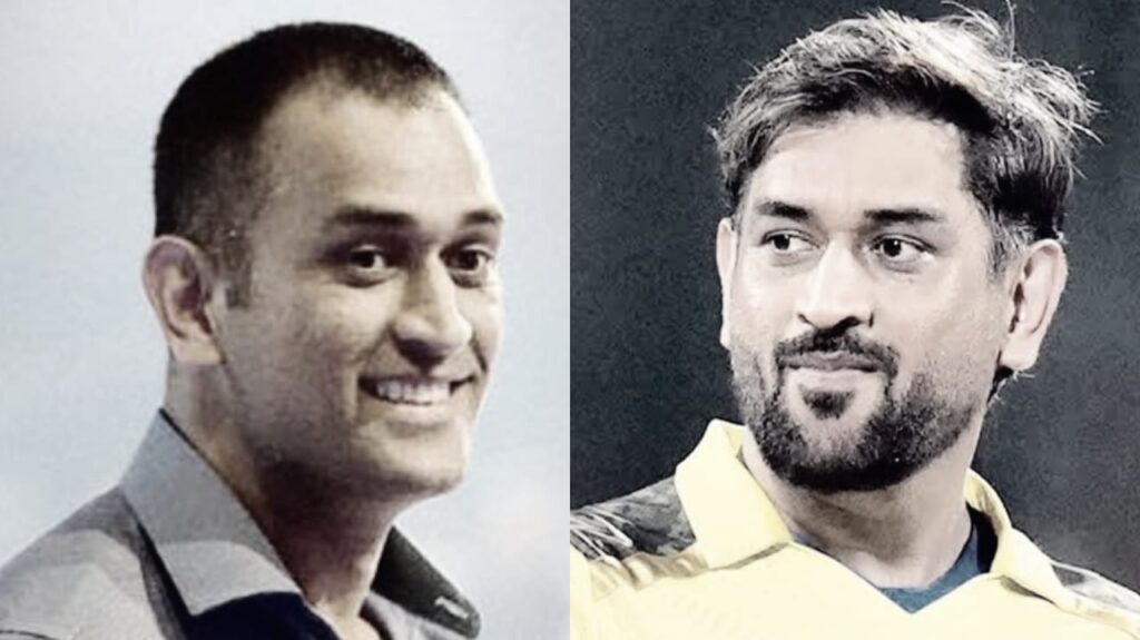 Bollywood Celebrity Hair Transplant Analysis - Alloroots Hair Transplant Clinic - India's Best Hair Transplant Services