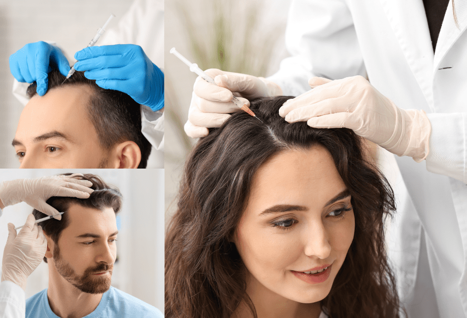 Hair Transplant Success Stories: Dubai Patients in India