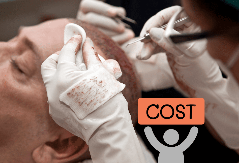 Hair Transplants Cost in Dubai - Complete Guide for 2025 & 2026