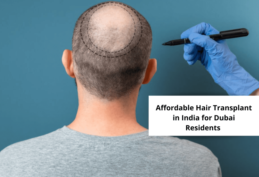 Why Dubai Marina Residents Choose India for Hair Transplants