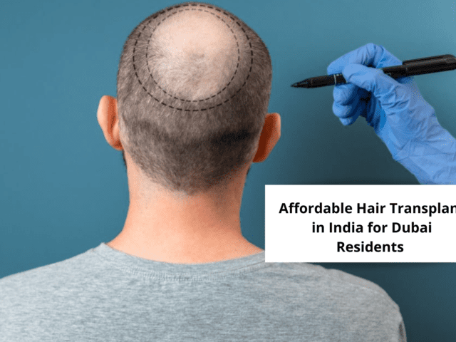 Why Dubai Marina Residents Choose India for Hair Transplants