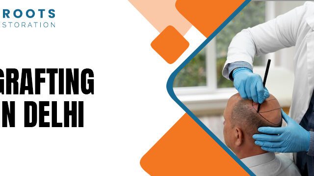 Hair Grafting Cost in Delhi 2025: Complete Guide to Charges, Packages, and Price Comparison