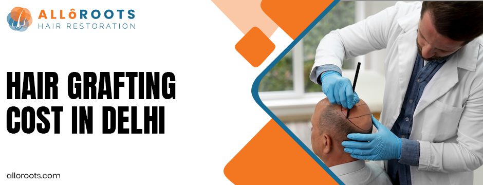 Hair Grafting Cost in Delhi 2025: Complete Guide to Charges, Packages, and Price Comparison - Alloroots Hair Transplant Clinic - India's Best Hair Transplant Services