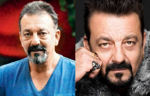 Bollywood Celebrity Hair Transplant Analysis 5 Hollywood Celebrity Hair Transplant Analysis - Alloroots Hair Transplant Clinic - India's Best Hair Transplant Services