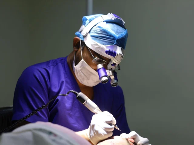 Is Hair Transplant Permanent? Everything You Need to Know