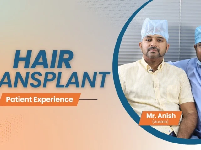 10 Best FUE Hair Transplant – Core Informational for FUE hair transplant India (2026)