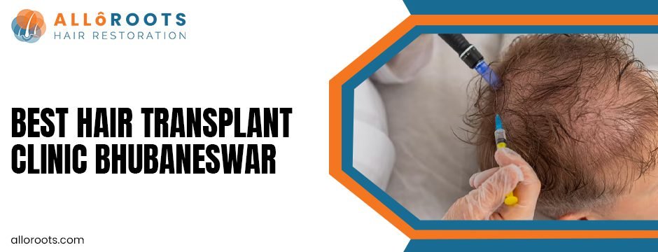 FUE vs FUT in Bhubaneswar: Which Technique Does the Best Clinic Recommend and Why? 2 Best hair transplant clinic Bhubaneswar