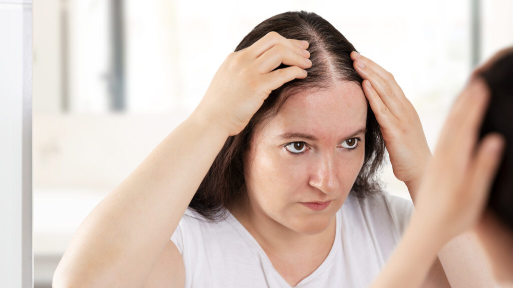 Women's Hair Loss Treatment Near Soami Nagar, Delhi - Alloroots Hair Transplant Clinic - India's Best Hair Transplant Services