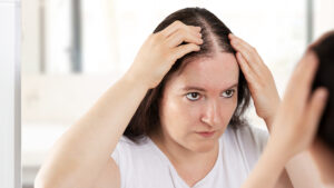 Women's Hair Loss Treatment Near Soami Nagar, Delhi - Alloroots Hair Transplant Clinic - India's Best Hair Transplant Services